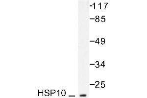 Image no. 1 for anti-Heat Shock 10kDa Protein 1 (Chaperonin 10) (HSPE1) antibody (ABIN265468) (HSPE1 抗体)