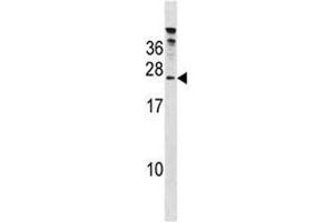 HTATSF1 antibody western blot analysis in 293 lysate. (HTATSF1 抗体  (AA 152-179))