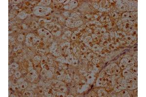 IHC image of ABIN7156399 diluted at 1:300 and staining in paraffin-embedded human adrenal gland tissue performed on a Leica BondTM system. (INTS1 抗体  (AA 51-342))