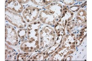 Image no. 9 for anti-Acetyl-CoA Acetyltransferase 2 (ACAT2) antibody (ABIN1496403) (ACAT2 抗体)