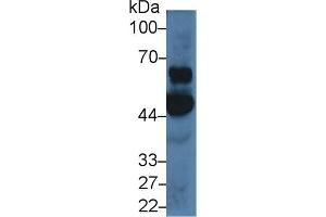 Detection of OAS1 in Porcine Cerebrum lysate using Polyclonal Antibody to 2',5'-Oligoadenylate Synthetase 1 (OAS1) (OAS1 抗体  (AA 74-165))