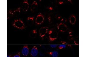 Immunofluorescence (IF) image for anti-USO1 Homolog, Vesicle Docking Protein (USO1) antibody (ABIN7258902)