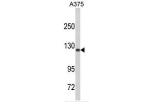 Western blot analysis of DSC1 Antibody (C-term) in A375 cell line lysates (35ug/lane). (Desmocollin 1 抗体  (C-Term))