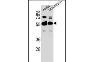 RGDS1 Antibody (Center) 1945c western blot analysis in HepG2,MDA-M cell line lysates (35 μg/lane). (RAP1GDS1 抗体  (AA 217-244))