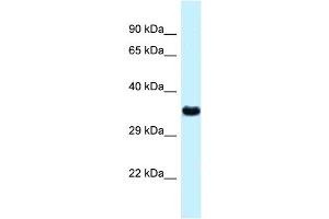 WB Suggested Anti-Ctsz Antibody   Titration: 1. (Cathepsin Z 抗体  (N-Term))