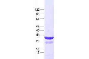 Western Blotting (WB) image for Odd-Skipped Related 1 (OSR1) protein (His tag) (ABIN2728006)