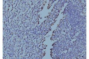 IHC analysis of EIF4A1 using anti-EIF4A1 antibody (ABIN7603144).