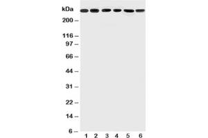 Western blot testing of Mucin-5AC antibody and Lane 1:  SGC (MUC5AC 抗体  (N-Term))