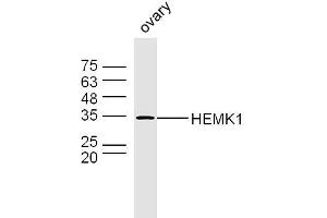Mouse ovary lysates probed with HEMK1 Polyclonal Antibody, Unconjugated  at 1:300 dilution and 4˚C overnight incubation. (HEMK1 抗体  (AA 21-120))