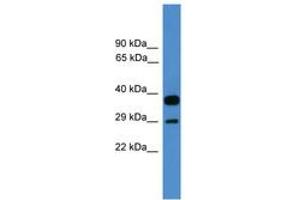 Image no. 1 for anti-OTU Domain, Ubiquitin Aldehyde Binding 2 (OTUB2) (AA 91-140) antibody (ABIN6745385) (OTUB2 抗体  (AA 91-140))