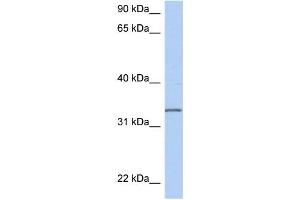 WB Suggested Anti-C3orf62 Antibody Titration: 0. (C3orf62 抗体  (Middle Region))
