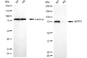 Western blotting analysis using GFPT1 antibody (ABIN7798748). (Recombinant GFPT1 抗体)