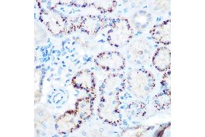 Immunohistochemistry of paraffin-embedded rat kidney using  Rabbit pAb (ABIN3015826, ABIN3015827, ABIN3015828 and ABIN6219178) at dilution of 1:100 (40x lens). (ANGPTL4 抗体  (AA 26-406))