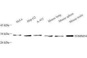 Western blot analysis of TOMM34 (ABIN7075984) at dilution of 1: 1000 (TOMM34 抗体)