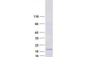 Validation with Western Blot