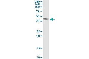 ART3 (Human) IP-WB Antibody Pair