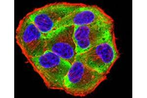 Immunofluorescence (IF) image for anti-Eukaryotic Translation Initiation Factor 4E Binding Protein 1 (EIF4EBP1) (pSer65) antibody (ABIN5611114)