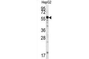Western Blotting (WB) image for anti-Matrix Metalloproteinase 20 (MMP20) antibody (ABIN3002549) (MMP20 抗体)