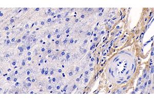 Immunohistochemistry (IHC) image for anti-Collagen, Type I, alpha 1 (COL1A1) (AA 253-471) antibody (ABIN7428014)
