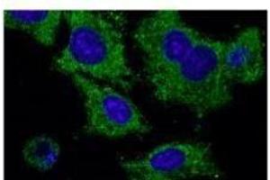 Anti-Rab2S Ab at 1/1,000 dilution, HEK293 cells transfected With GFP-Rab25, rabbit polyclonal to goat lµg (HRP) at 1/10,000 dilution, (RAB25 抗体  (C-Term))