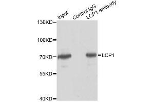 Immunoprecipitation analysis of 150ug extracts of Jurkat cells using 3ug LCP1 antibody. (LCP1 抗体  (AA 1-270))