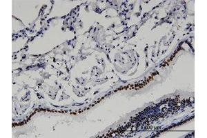 Image no. 1 for anti-Bromodomain Adjacent To Zinc Finger Domain, 2B (BAZ2B) (AA 1833-1932) antibody (ABIN599553) (BAZ2B 抗体  (AA 1833-1932))