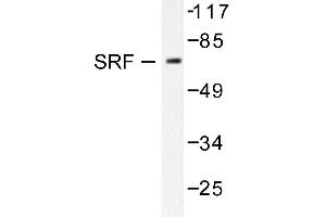 Image no. 1 for anti-Serum Response Factor (SRF) antibody (ABIN271823) (SRF 抗体)