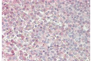 Immunohistochemistry (IHC) image for anti-Atonal Homolog 1 (Drosophila) (ATOH1) (Middle Region) antibody (ABIN2779592)