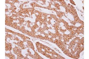 Immunohistochemistry (IHC) image for anti-Tubulin, beta (TUBB) antibody (ABIN2854998)