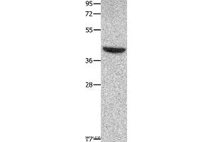 Western blot analysis of Mouse heart tissue, using MMP28 Polyclonal Antibody at dilution of 1:350 (MMP28 抗体)