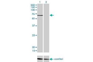 Western blot analysis of CACNB1 over-expressed 293 cell line, cotransfected with CACNB1 Validated Chimera RNAi (Lane 2) or non-transfected control (Lane 1).