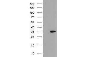 Image no. 1 for anti-Src-like-adaptor 2 (SLA2) antibody (ABIN1500953) (SLAP2 抗体)