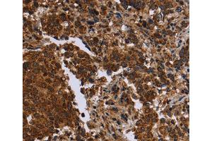 Immunohistochemistry (IHC) image for anti-Formin 2 (FMN2) antibody (ABIN5546665) (Formin 2 抗体)