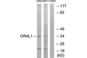 Western Blotting (WB) image for anti-Olfactory Receptor, Family 4, Subfamily L, Member 1 (OR4L1) (AA 262-311) antibody (ABIN2891013) (OR4L1 抗体  (AA 262-311))