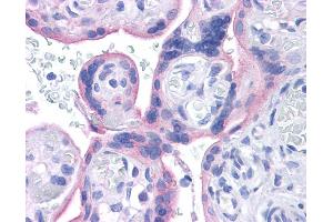INSR antibody was used for immunohistochemistry at a concentration of 4-8 ug/ml. (Insulin Receptor 抗体  (Middle Region))