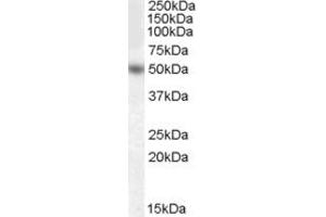 Western Blotting (WB) image for anti-Early Growth Response 4 (EGR4) (Internal Region) antibody (ABIN2465639) (EGR4 抗体  (Internal Region))