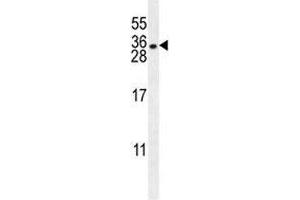 HLA-DQA1 antibody western blot analysis in NCI-H460 lysate. (HLA-DQA1 抗体  (AA 39-66))
