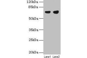 Western blot All lanes: PTPN6 antibody at 12 μg/mL Lane 1: Jurkat whole cell lysate Lane 2: Raji whole cell lysate Secondary Goat polyclonal to rabbit IgG at 1/10000 dilution Predicted band size: 68, 64, 71 kDa Observed band size: 68 kDa (SHP1 抗体  (Isoform 2))