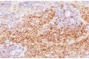 Immunohistochemistry of paraffin-embedded Rat spleen using CD38 Polycloanl Antibody at dilution of 1:200 (CD38 抗体)