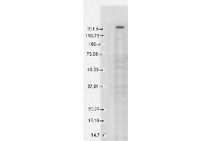 Western Blotting (WB) image for anti-Transient Receptor Potential Cation Channel, Subfamily M, Member 7 (TRPM7) (AA 1817-1863) antibody (ABIN361775)