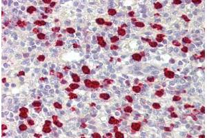 Anti-PARIS / ZNF746 antibody IHC staining of human spleen. (ZNF746 抗体  (AA 395-444))