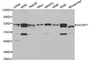 Western blot analysis of extracts of various cell lines, using IGF2BP1 antibody. (IGF2BP1 抗体)