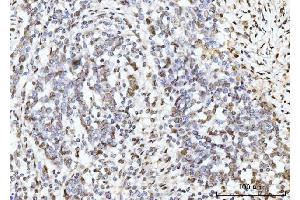 IHC analysis of ARL6IP6 using anti-ARL6IP6 antibody (ABIN7603020). (ARL6IP6 抗体  (Middle Region))