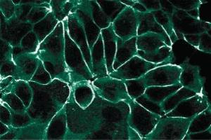 Immunofluorescence staining of MCF7 cells. (JUP 抗体  (AA 553-738))