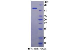SDS-PAGE analysis of Human SECTM1 Protein.