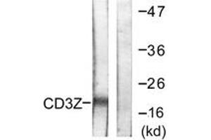 Western blot analysis of extracts from Jurkat cells, treated with UV 15', using CD3 zeta (Ab-42) Antibody. (CD247 抗体  (AA 111-160))