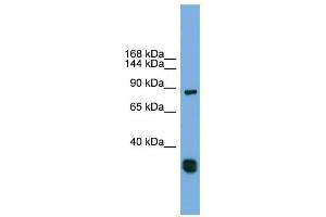 FSTL5 antibody used at 1 ug/ml to detect target protein. (FSTL5 抗体  (Middle Region))