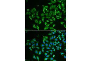 Immunofluorescence analysis of HeLa cells using CLEC3B/Tetranectin antibody (ABIN6130014, ABIN6138710, ABIN6138712 and ABIN6222056). (CLEC3B 抗体  (AA 22-202))