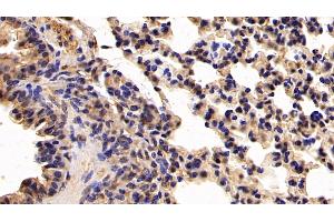 Immunohistochemistry (IHC) image for anti-Keratin 19 (KRT19) (AA 1-403) antibody (ABIN7436894)