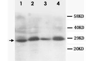 Western Blot analysis of SSX2 expression from cell extracts with SSX2 polyclonal antibody . (SSX2 抗体  (C-Term))
